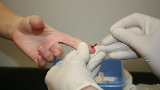 hiv-1