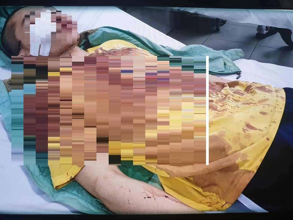 dap-pha-noi-o-cua-5-chu-tieu 4