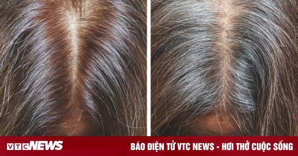 5 hậu quả tai hại nếu bạn gội đầu quá thường xuyên 5 hậu quả tai hại nếu bạn gội đầu quá thường xuyên