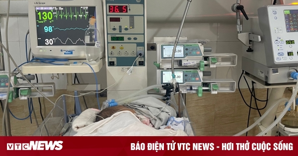 Mắc virus lây qua nụ hôn, trẻ 39 ngày tuổi nguy kịch