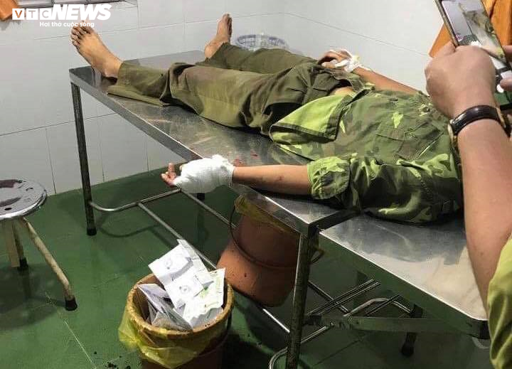 Khởi tố kẻ chém cán bộ kiểm lâm Vườn quốc gia Yok Đôn trọng thương - 1