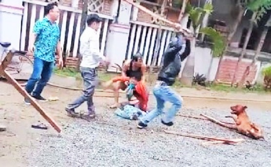 Chủ đi vắng, chó Pitbull tuột xích cắn nát tay người phụ nữ - 1