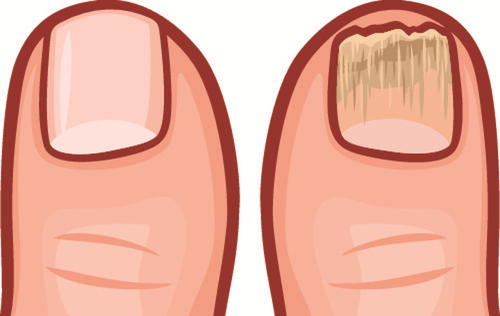 9 dấu hiệu cho thấy cơ thể bạn đang chứa nhiều độc tố - 8