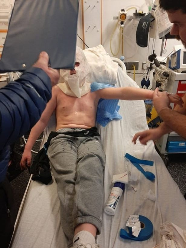 Bắt chước trò nghịch dại trên Youtube, cậu bé 10 tuổi bỏng nặng - 2