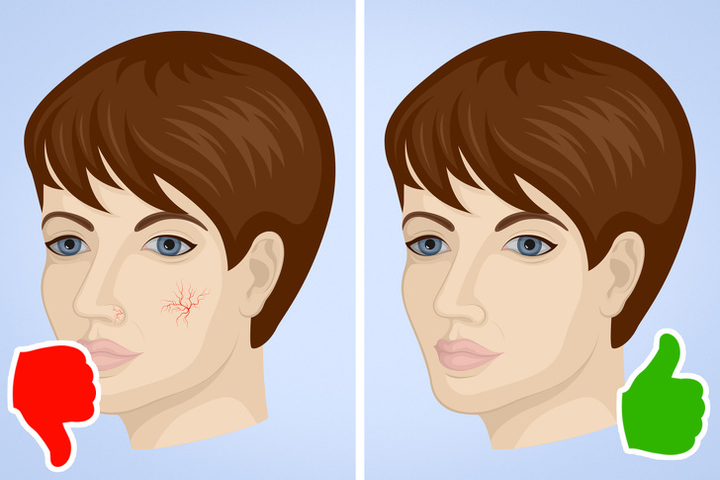 Những dấu hiệu cảnh báo gan bị tổn thương, cần đi khám bác sĩ ngay - 5