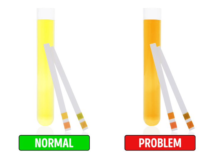 Những dấu hiệu cảnh báo gan bị tổn thương, cần đi khám bác sĩ ngay - 7