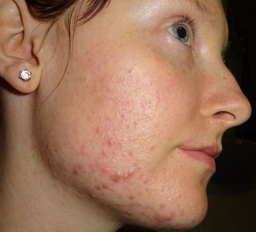 7 dấu hiệu cảnh báo sức khỏe có vấn đề mà phụ nữ thường bỏ qua - 2