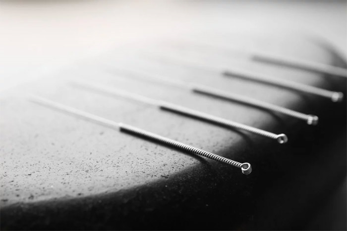 Châm cứu điện - giải pháp hữu hiệu trong điều trị ung thư? - 1