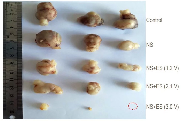 Châm cứu điện - giải pháp hữu hiệu trong điều trị ung thư? - 2