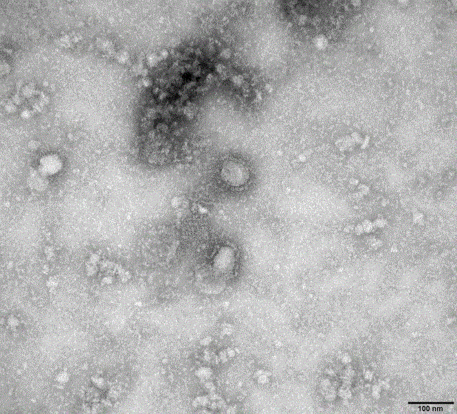 Cập nhật dịch cúm corona đến 30/1: 170 người chết - 10