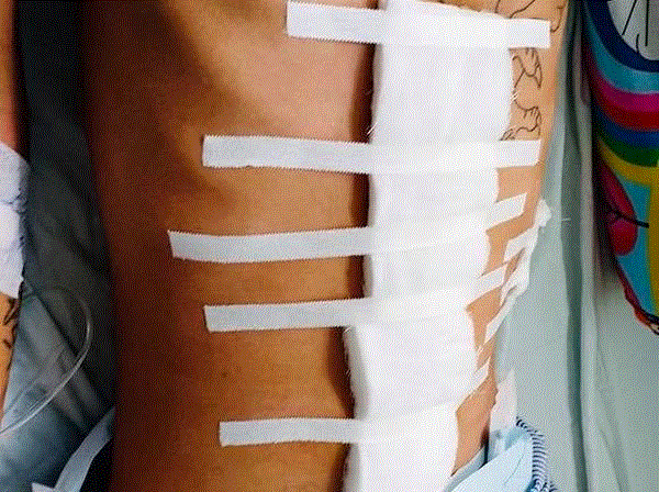 Bắt kẻ cầm đầu nhóm thanh niên xả súng khiến 4 người bị thương - 1