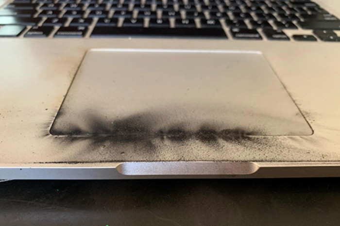 Máy tính phát nổ, bé trai bỏng nặng