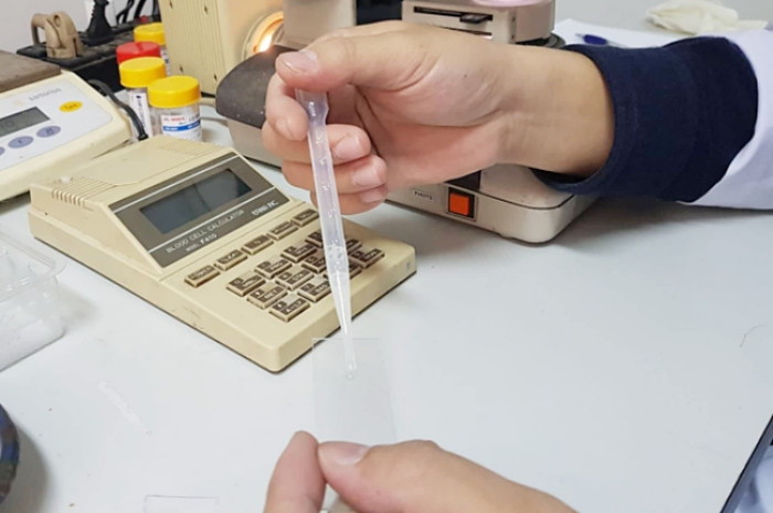 Gửi tinh trùng vào ngân hàng chờ làm bố