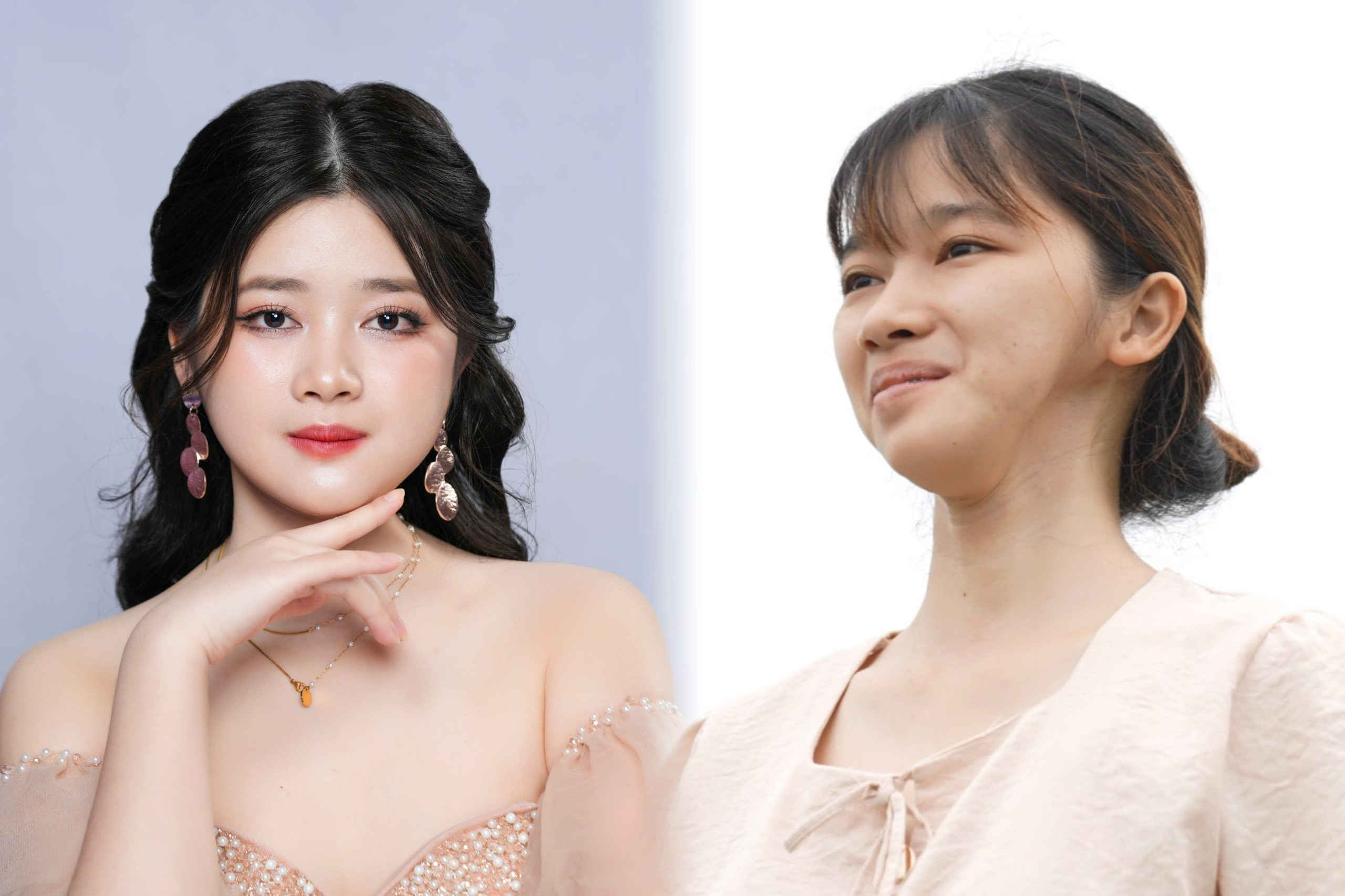 Cô gái 'mặt lõm' lột xác sau 4 cuộc đại phẫu