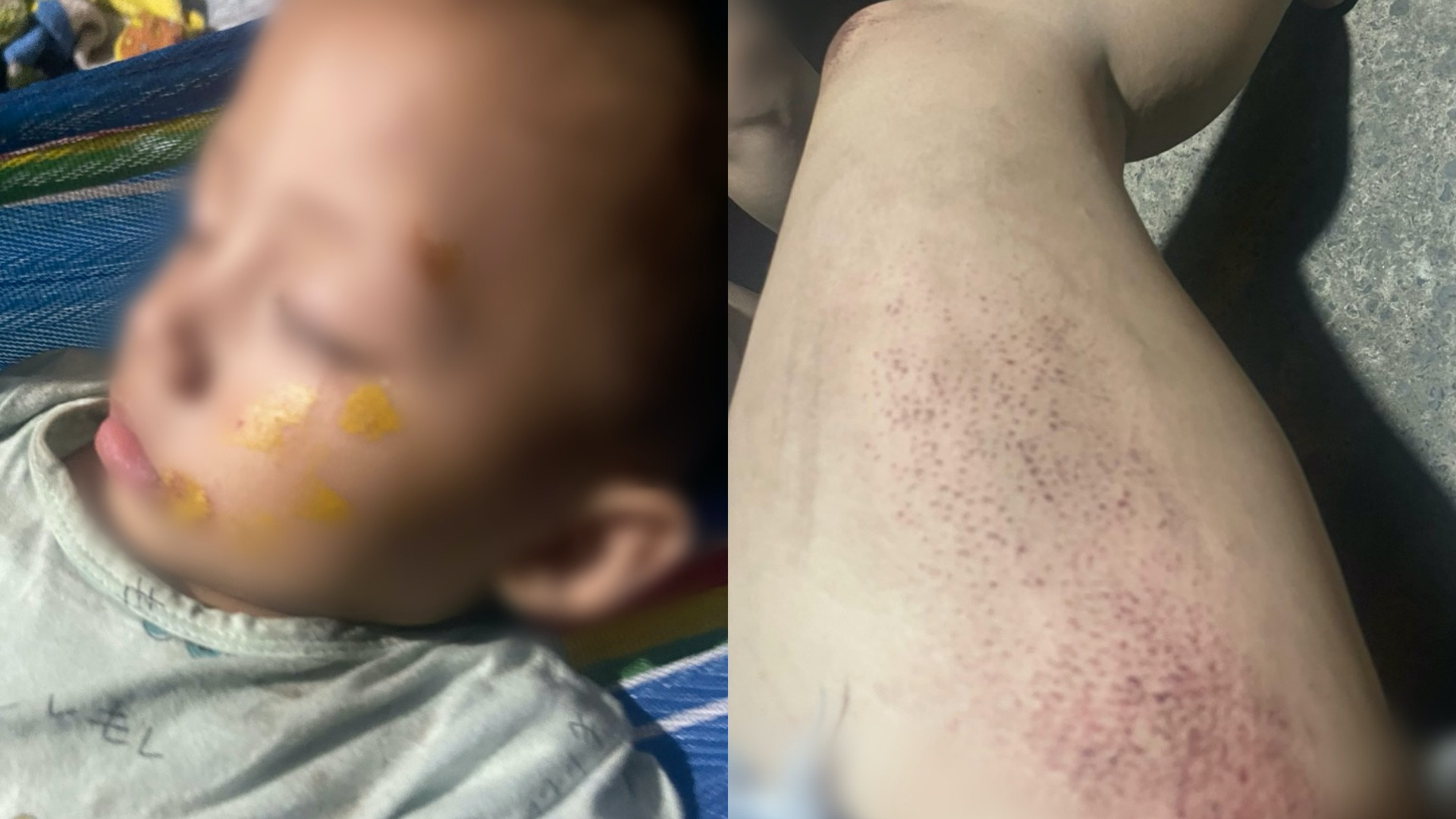 Xót xa cảnh người mẹ chở con 19 tháng bị cướp lúc nửa đêm, ngã xuống đường