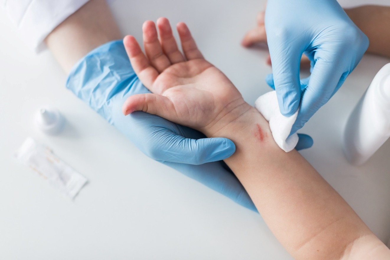 Chăm sóc vết thương, đừng để có sẹo mới lo xử trí