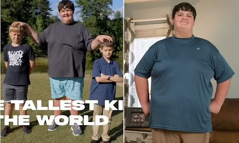 Cậu bé 10 tuổi cao 1,9m và những rắc rối do thân hình khổng lồ