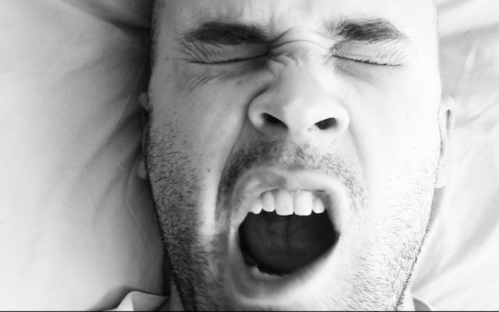 Trật khớp quai hàm, không khép được miệng do ngáp lớn