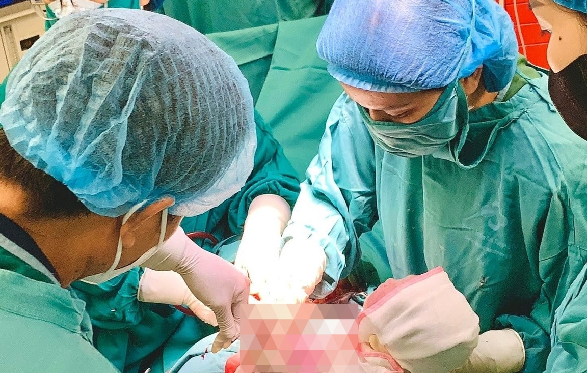 Hai em bé chào đời cùng vòng tránh thai của mẹ