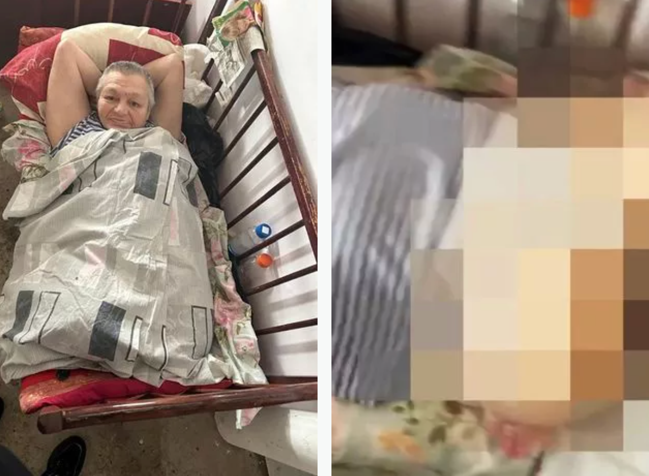 Bị chuột 'ăn thịt' trong khi say rượu, người phụ nữ mất cả 2 chân 