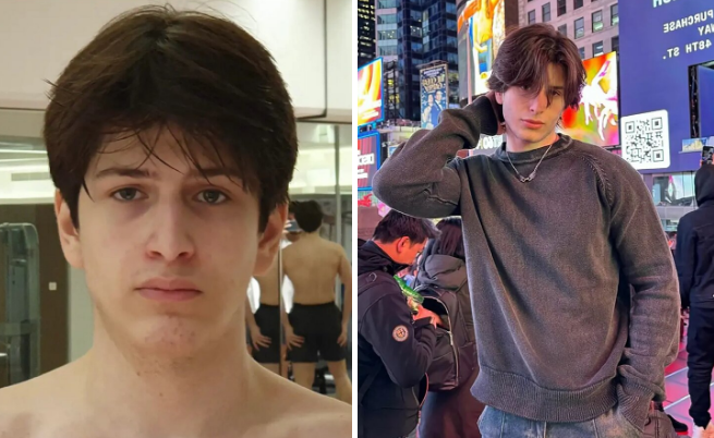 Trai gen Z đua nhau chi 'tiền tấn' phẫu thuật thẩm mỹ để giống ngôi sao