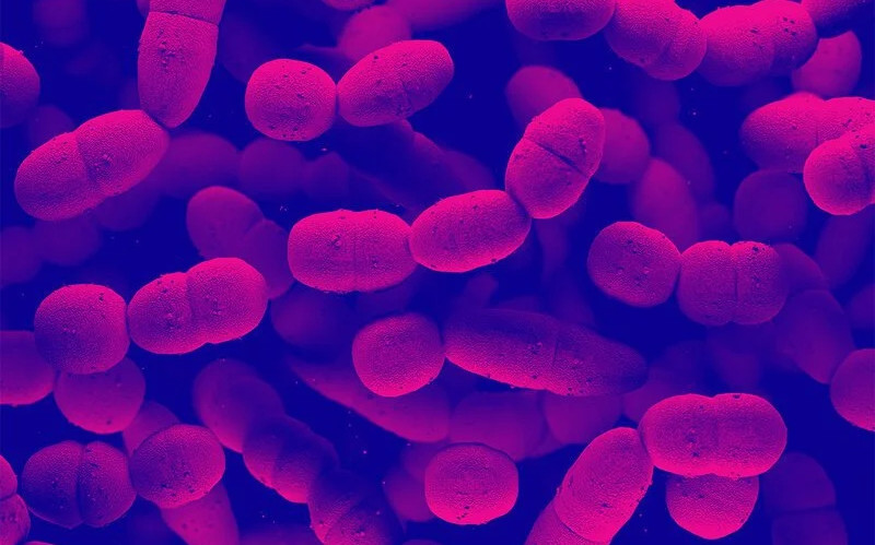 Suy đa tạng sau mổ lợn