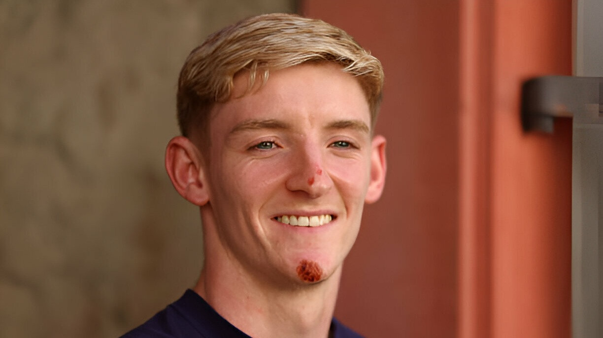 Mải dùng điện thoại khi đạp xe, sao tuyển Anh tai nạn suýt mất mạng