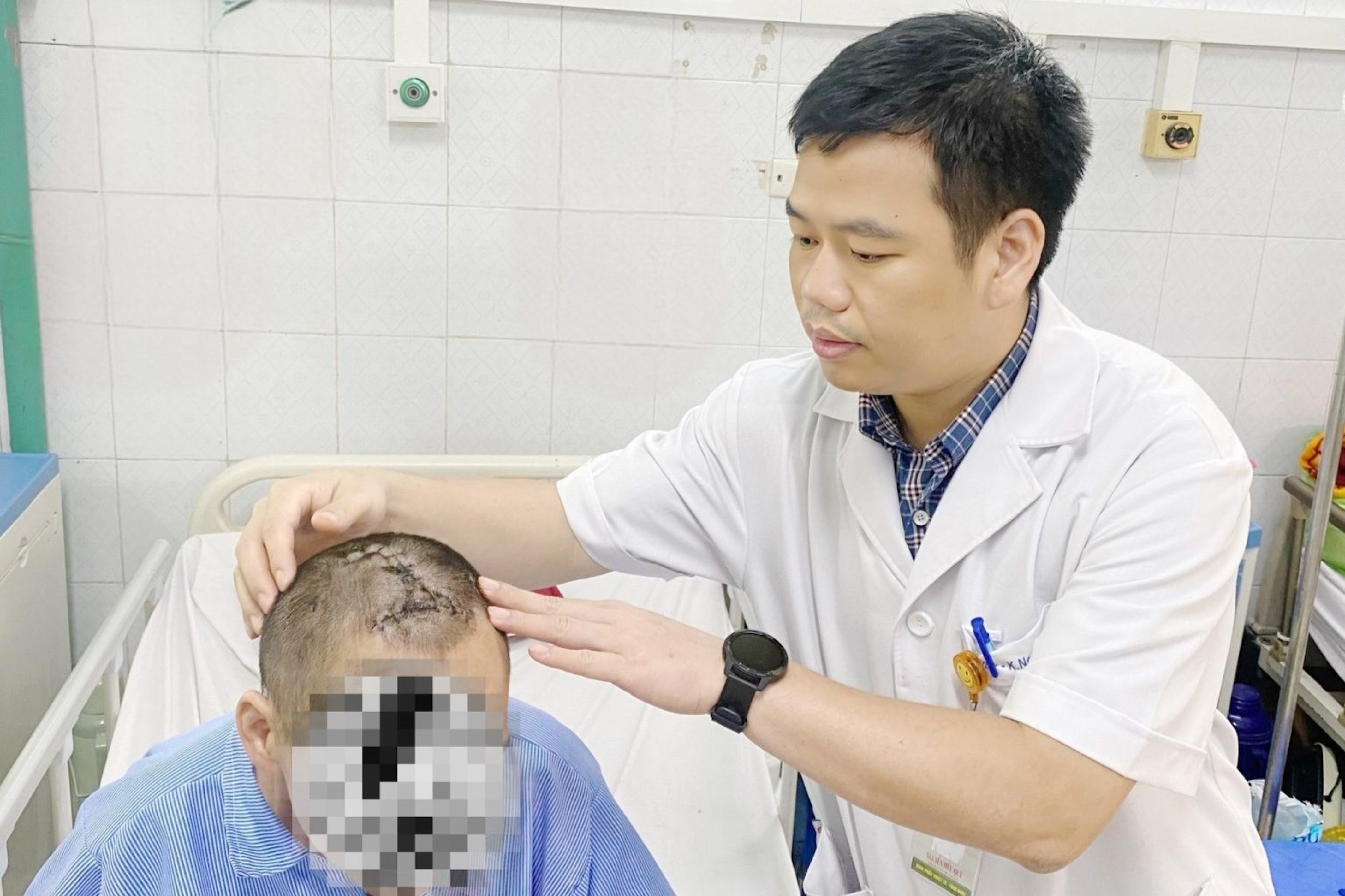 Người đàn ông trầm cảm tự đóng đinh sắt vào đầu