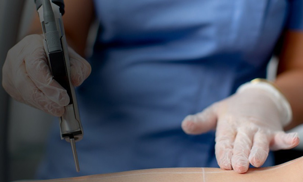 Có nên triệt lông vùng kín?