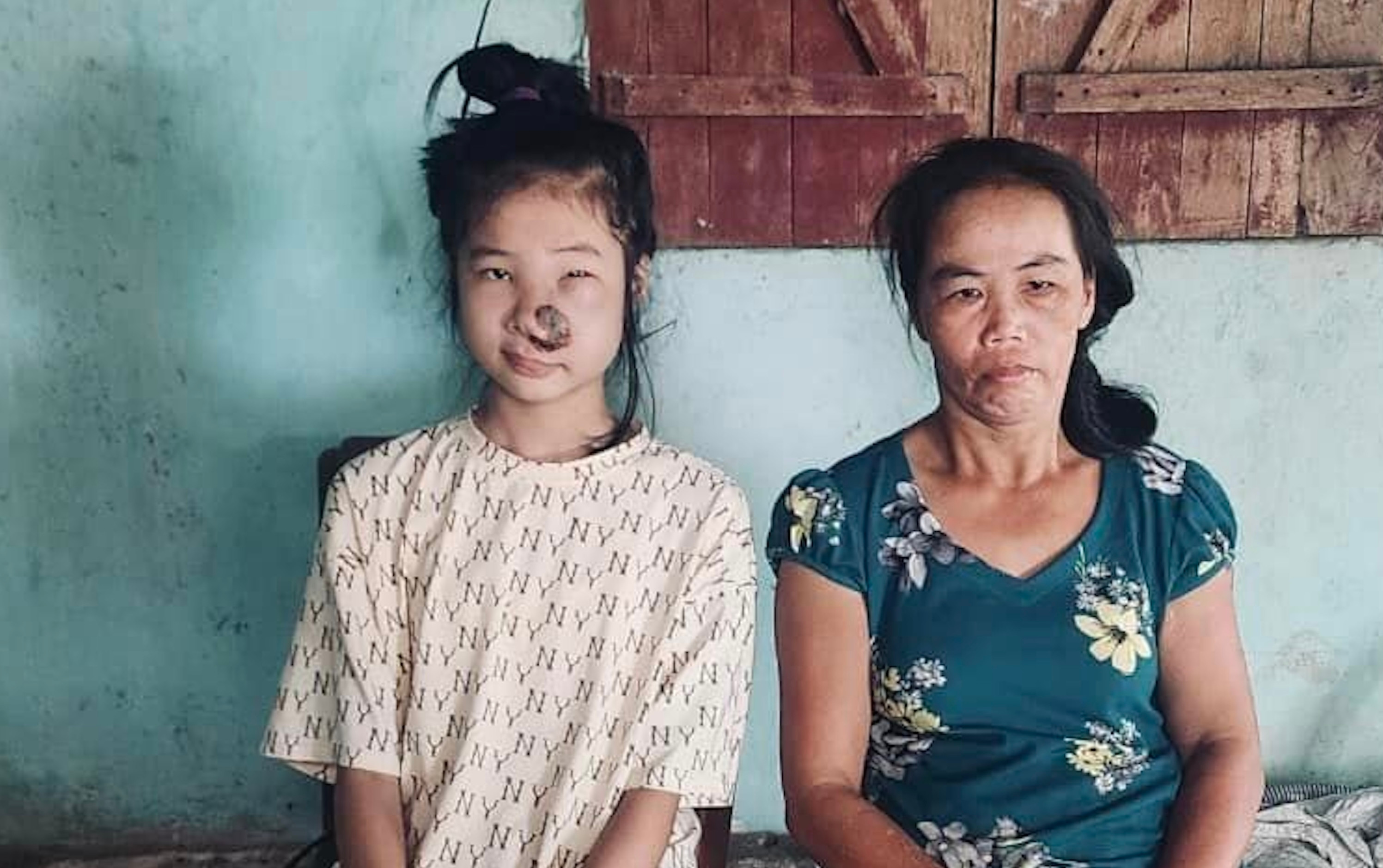 Mẹ tâm thần, bé gái 14 tuổi lại nhận tin bị ung thư