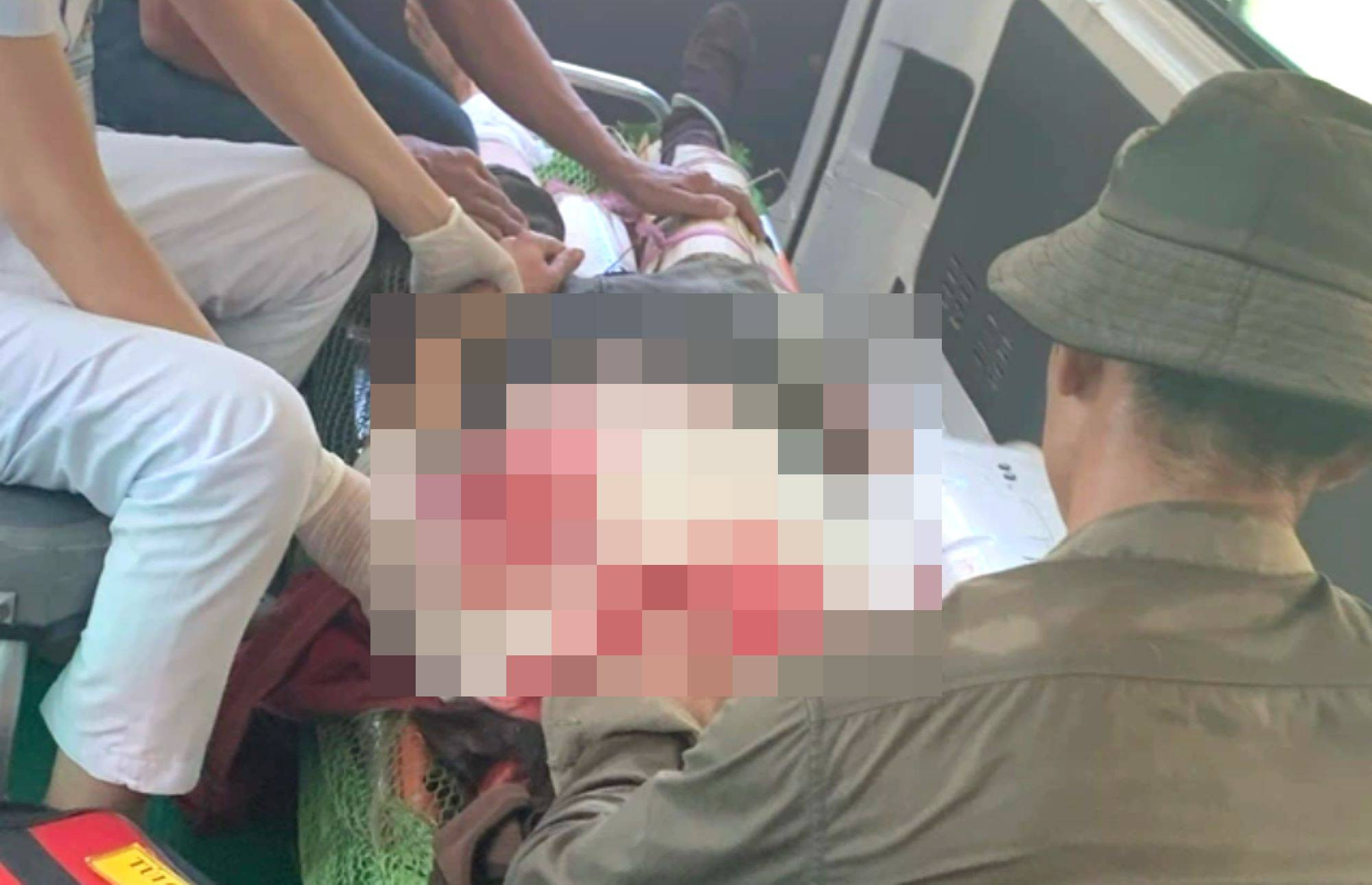 Người phụ nữ bị đá lớn lăn trúng người khi đi làm rừng, chấn thương sọ não