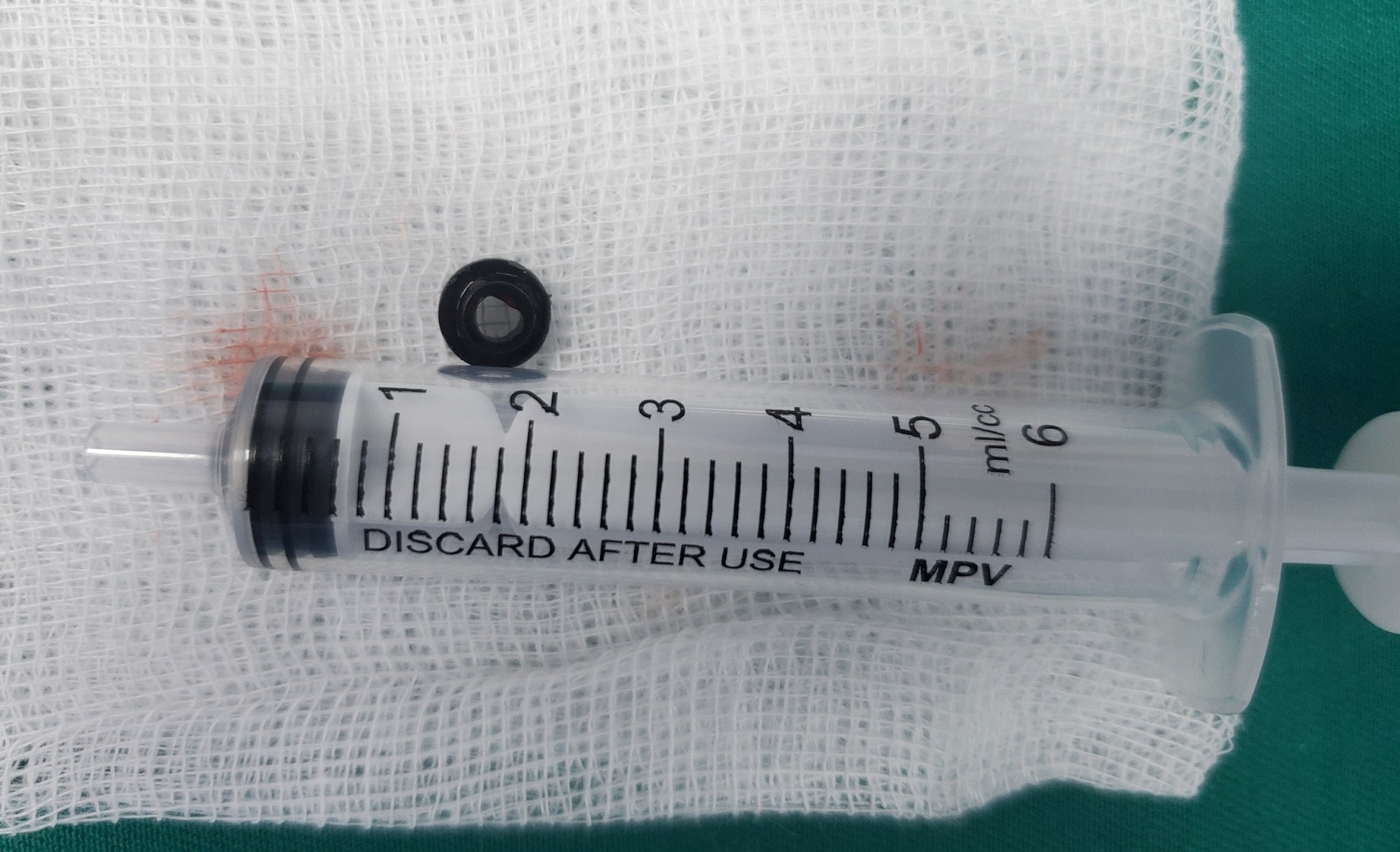 Mảnh lego mắc kẹt trong đường thở bé 10 tuổi