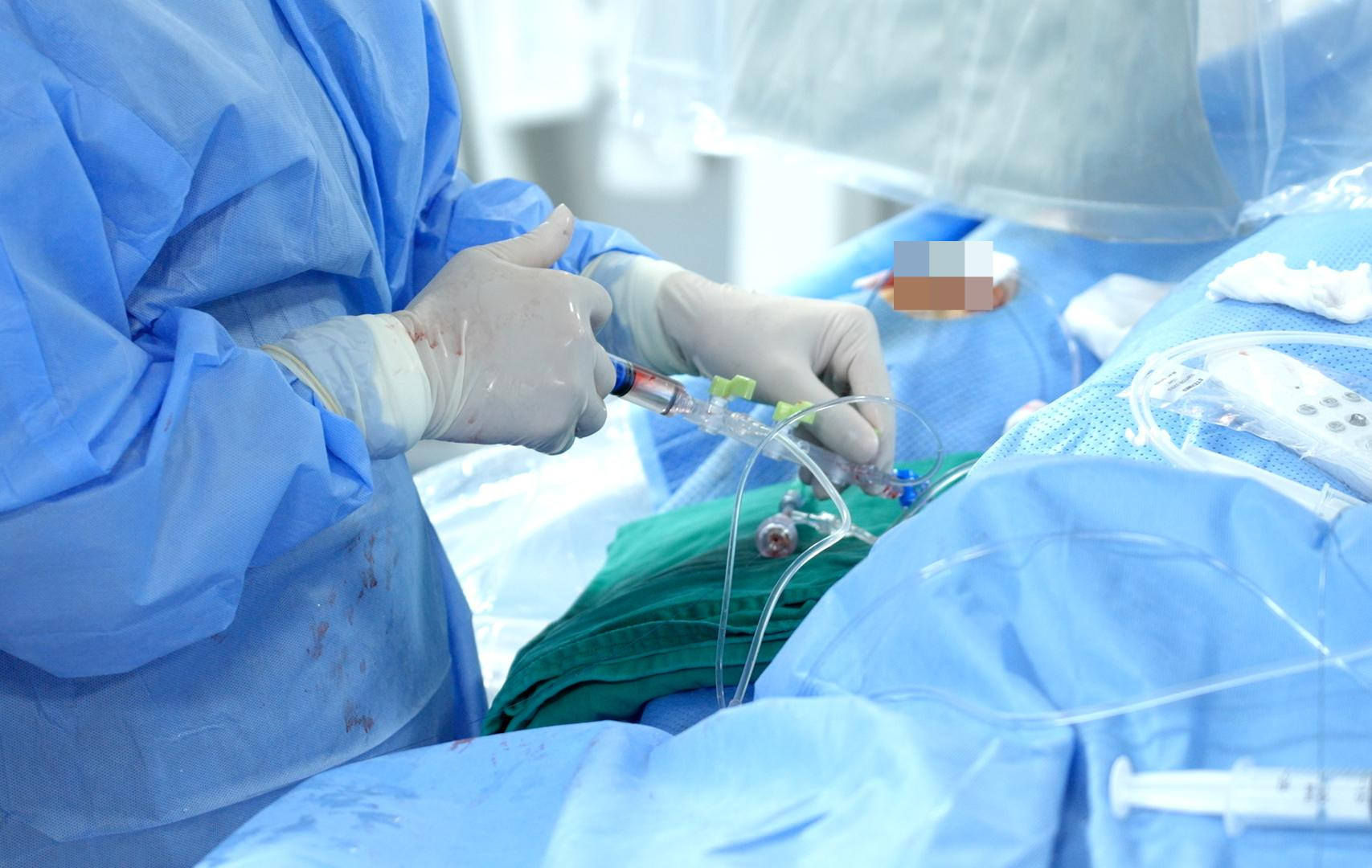 Nhồi máu cơ tim sau cuộc nhậu với bạn bè