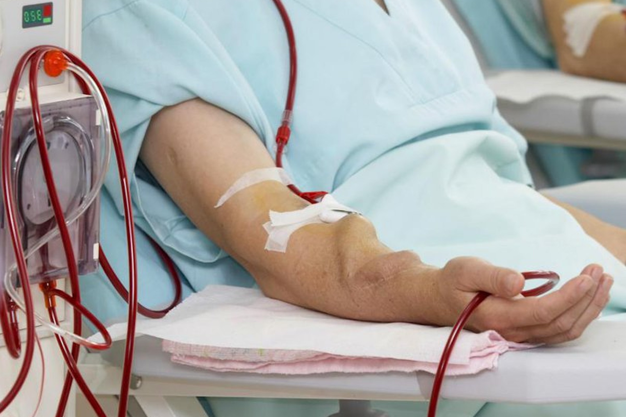 Suy thận ở tuổi 22