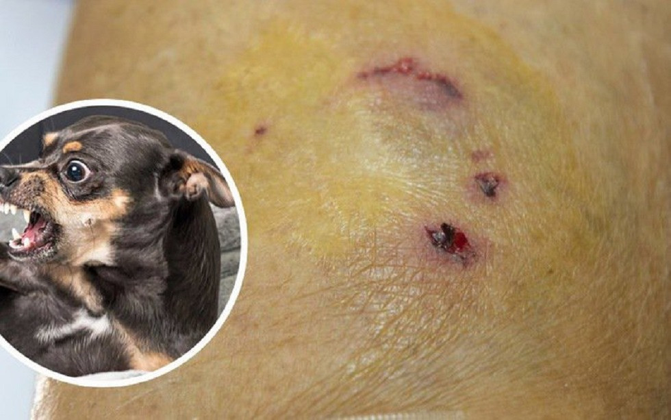 Sau hơn 1 tháng bị chó dại xông vào trường cắn, bé trai 7 tuổi tử vong 