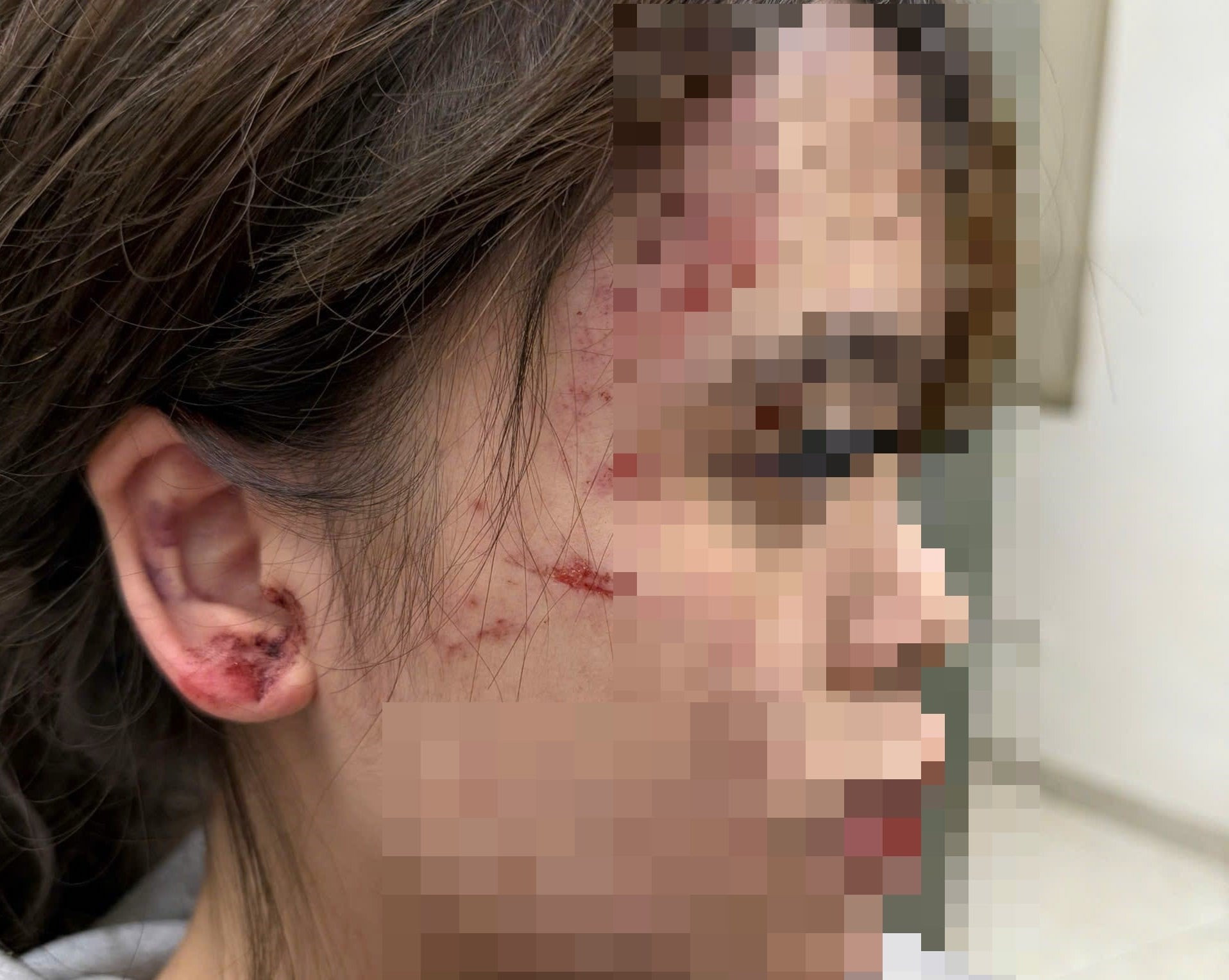 Lời kể của thiếu nữ bị nhóm người đánh hội đồng, bắt quỳ xin lỗi