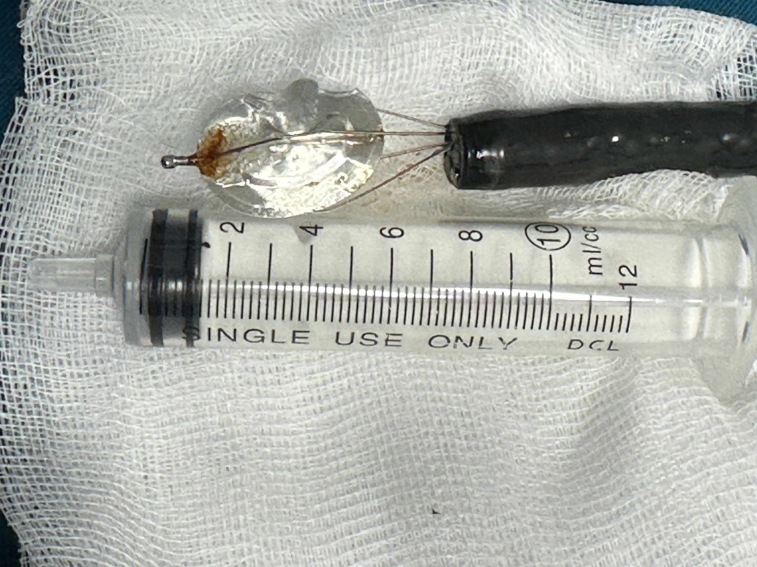 Gắp nắp lon nước ngọt trong dạ dày bé trai 11 tuổi ở Quảng Ngãi