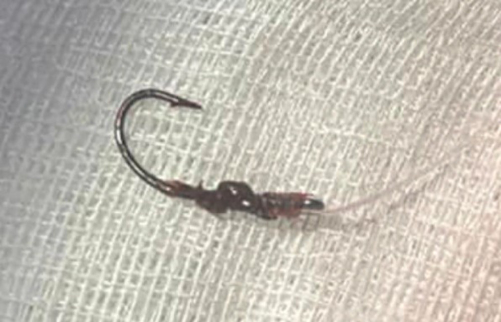 Đi câu cá, người đàn ông bị lưỡi câu móc trúng mí mắt trái