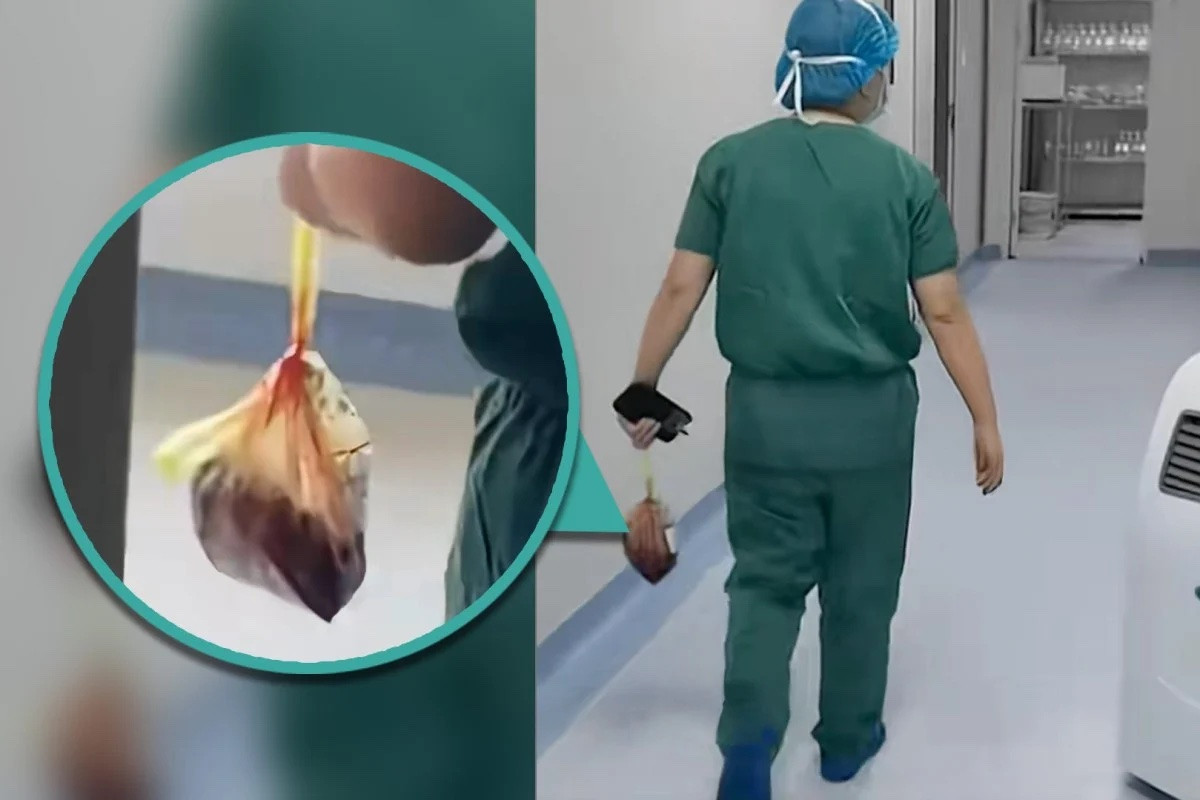 Bác sỹ ăn cắp nhau thai của hàng loạt sản phụ bị sa thải