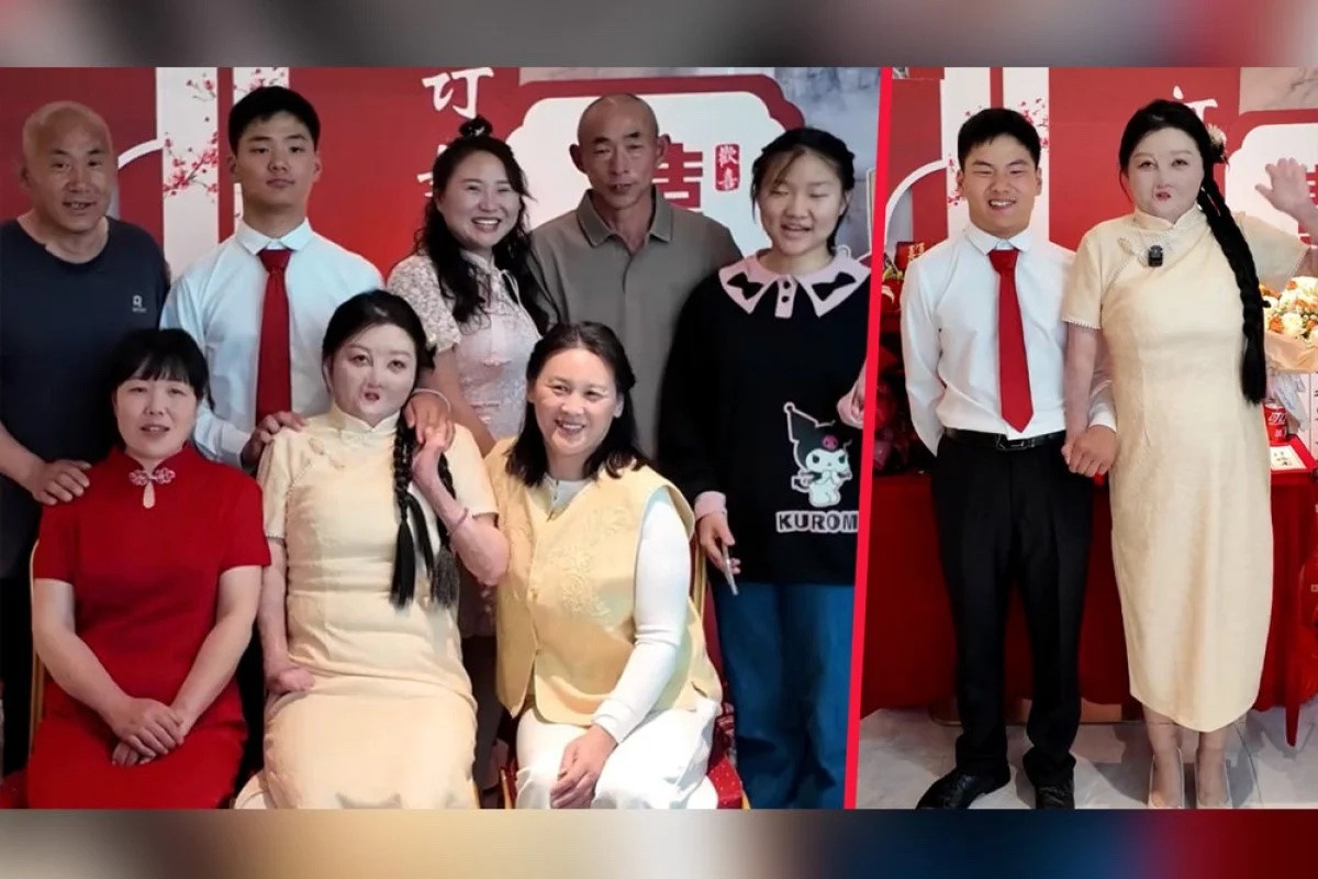 Duyên phận kỳ lạ của cô gái bỏng 95% cơ thể với người chồng sinh cùng ngày