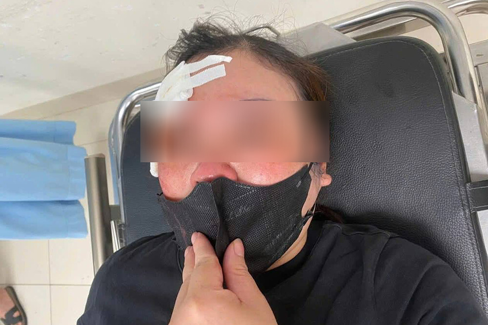 Xác minh thông tin người phụ nữ bị tài xế ô tô bán tải dùng dùi cui vụt vào đầu