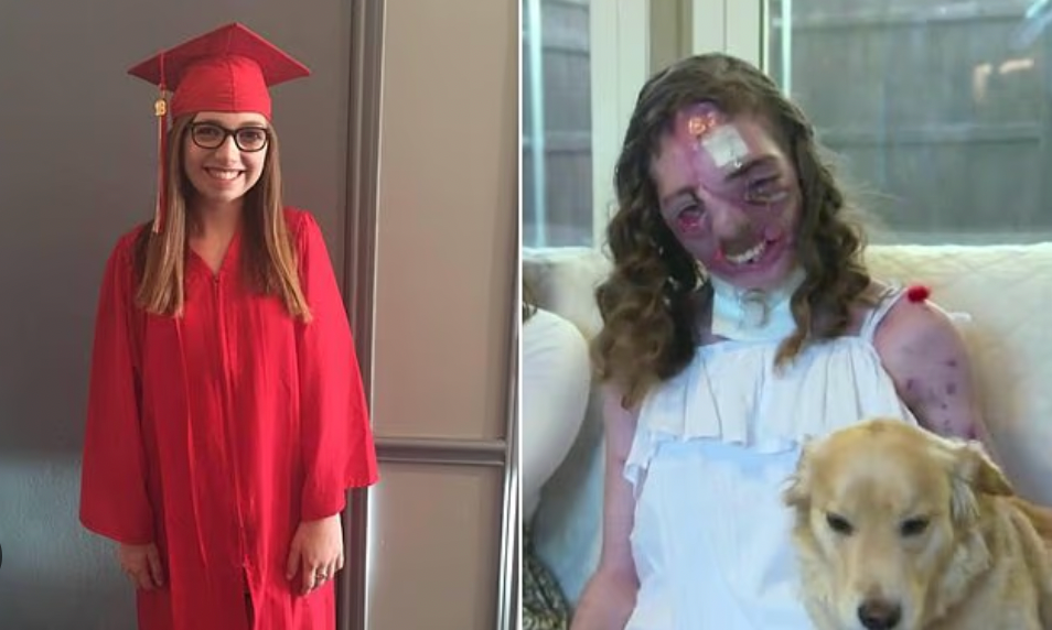 Cô gái bị chó dữ cắn 800 nhát trên mặt có diện mạo mới sau 4 năm phẫu thuật