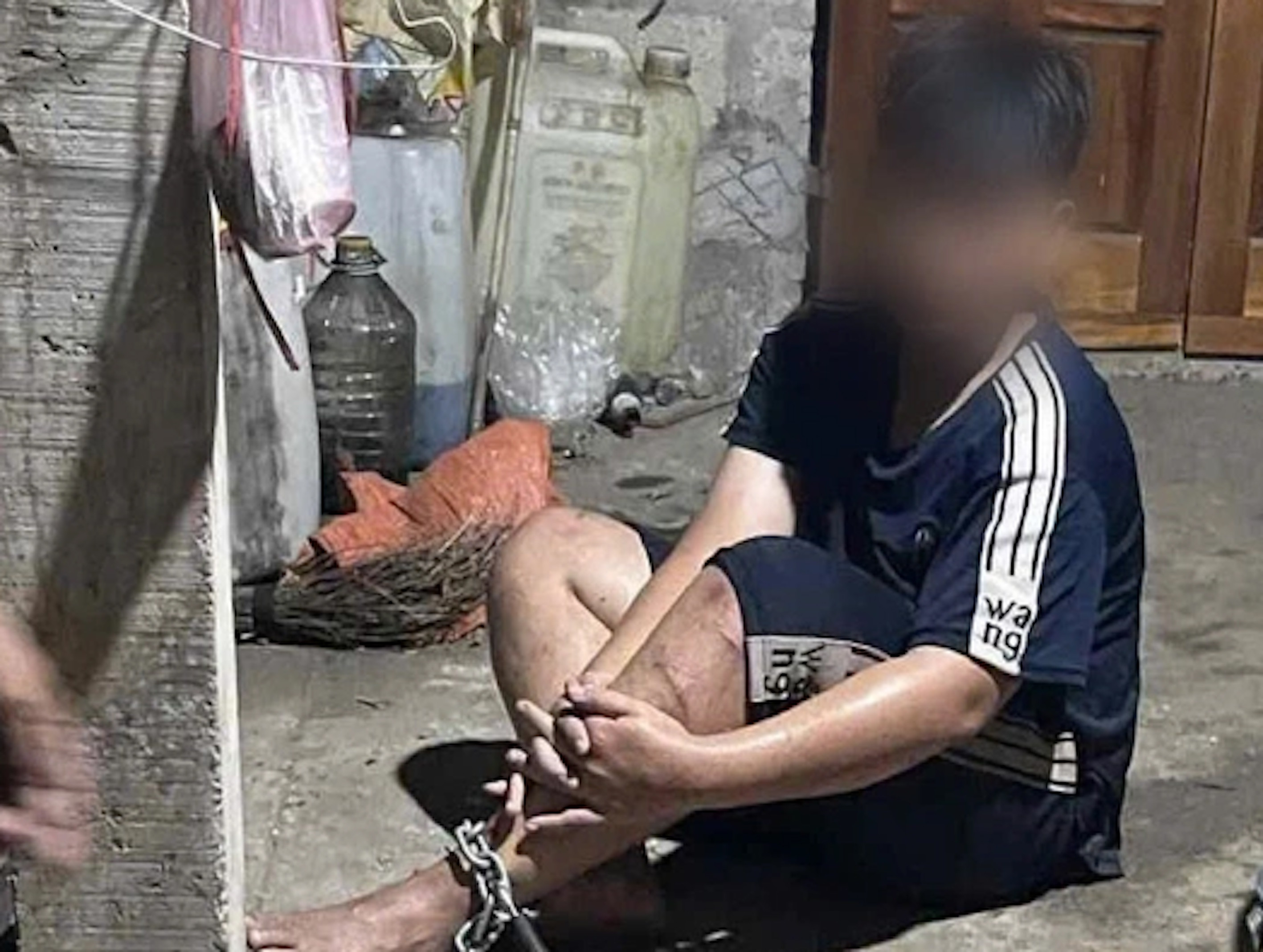 Làm rõ việc nam sinh ở Huế bị người đàn ông xích chân, hành hung