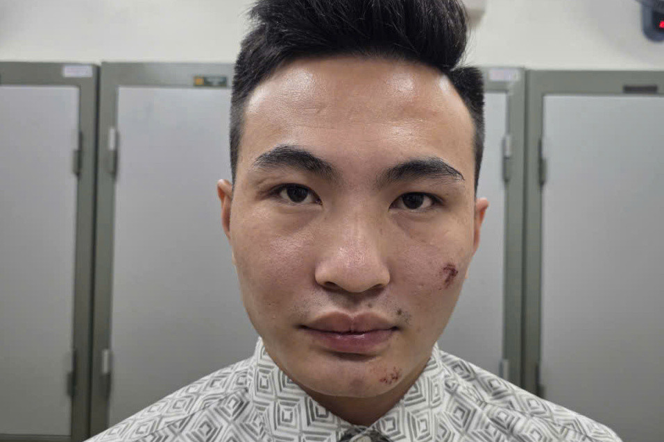 Tạm giữ thanh niên có nồng độ cồn, lao xe máy vào công an tại chốt bảo vệ A80