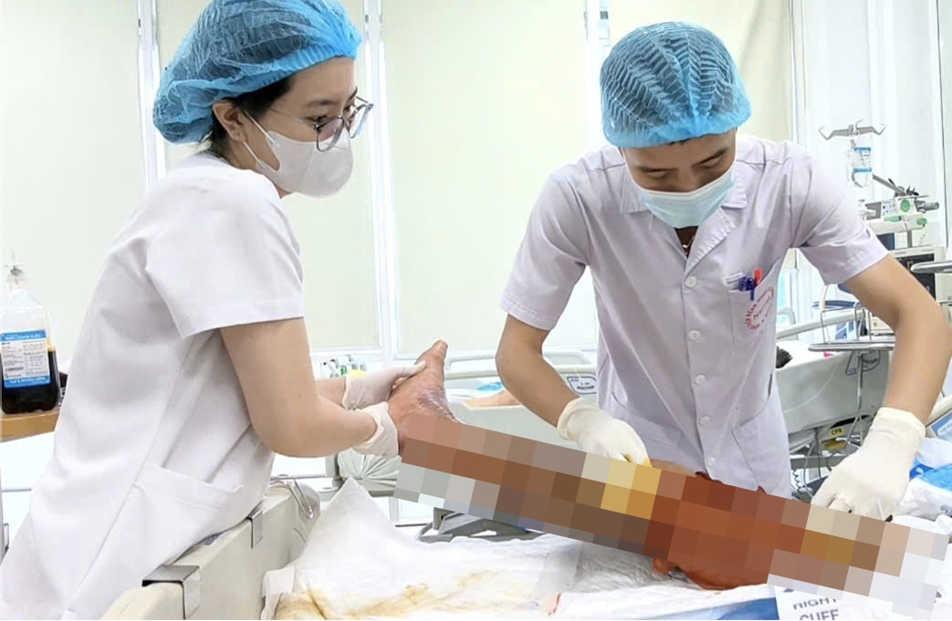 Vết thương nhỏ khi làm ruộng khiến người đàn ông sốc nhiễm trùng