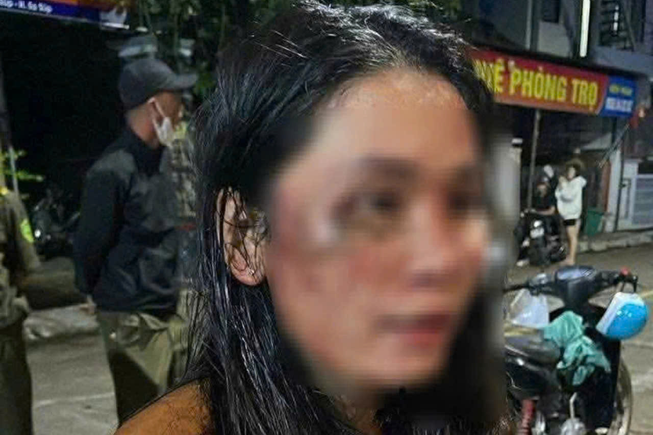 Điều tra vụ nữ shipper ở Đắk Lắk bị khách hành hung đến nhập viện