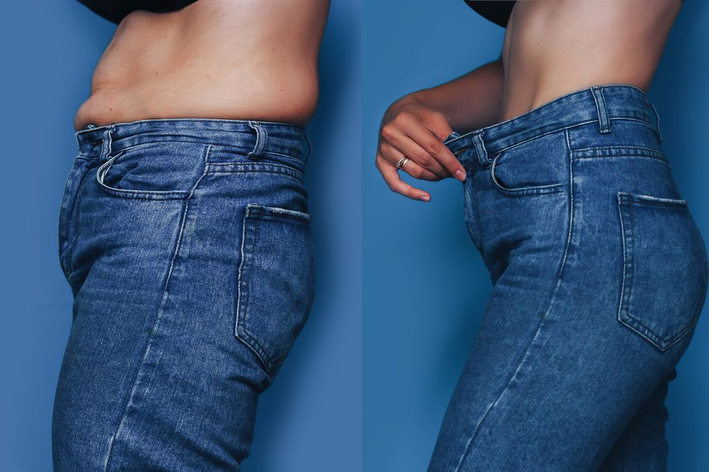 Phẫu thuật ‘nắn’ xương sườn giúp cô gái gen Z có vòng eo con kiến, giảm 15cm