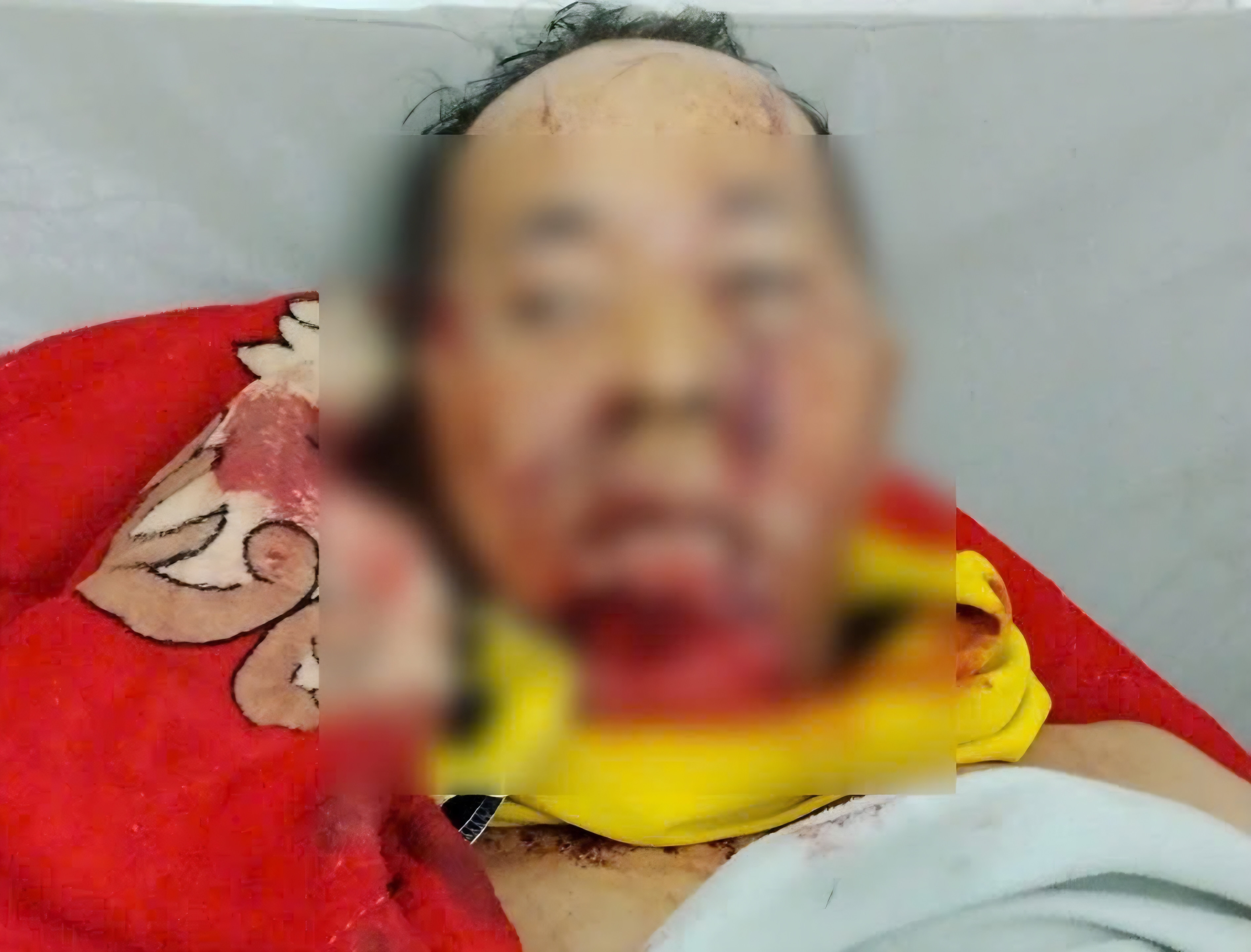 Trưởng thôn ở Đà Nẵng bị gấu rừng tấn công