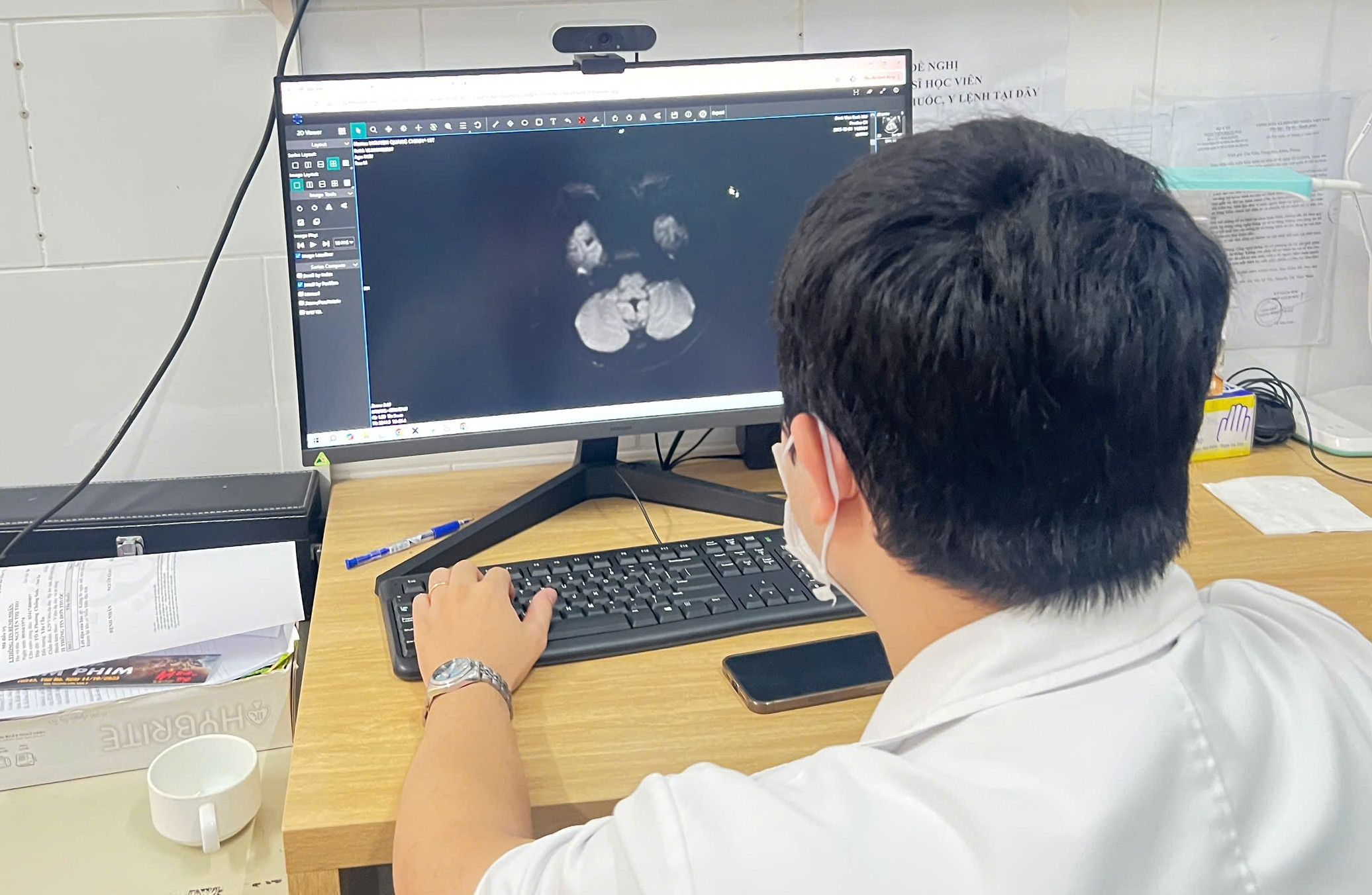 Tổn thương não, suy thận do hút thuốc lá điện tử chứa ma túy tổng hợp