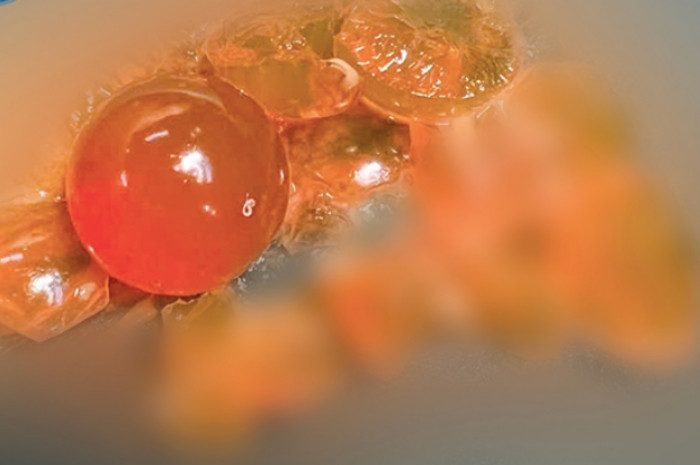 Bé trai 14 tháng tuổi phải nhập viện vì nuốt hạt nở đồ chơi